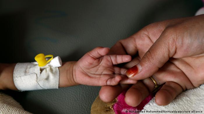 Милиони деца по света гладуват. А над 1 милион умират