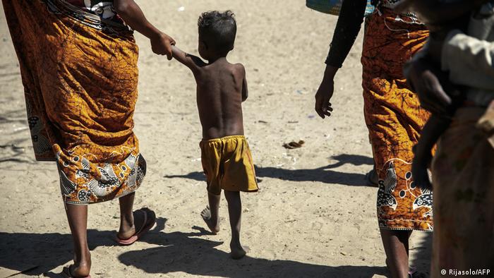 Недохранено дете в Мадагаскар