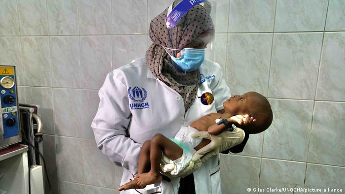 Doctora de una agencia de la ONU sostinene a un infante malnutrido en Yemen