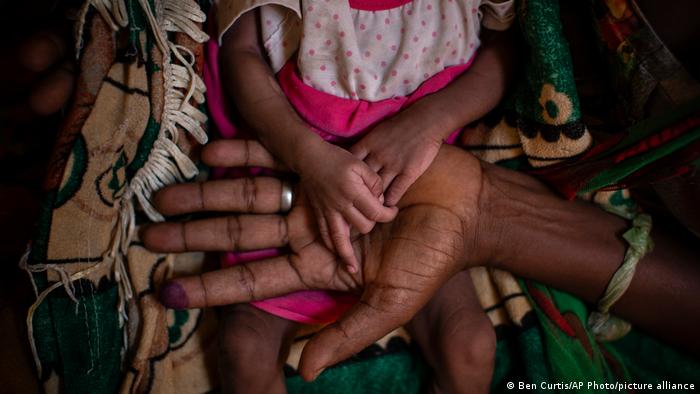 Abeba Gebru, 37, from the village of Getskimilesley, holds the hands of her malnourished daughter, Tigsti Mahderekal, 20 days old, in the treatment tent of a medical clinic in the town of Abi Adi, in the Tigray region of northern Ethiopia on May 11, 2021.