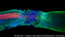 Dancing molecules’ successfully repair severe spinal cord injuries
Longitudinal spinal cord section treated with the most bioactive therapeutic scaffold. Regenerated axons (red) regrew within the lesion.