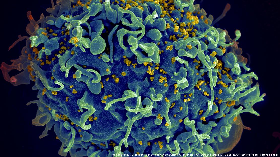 Una célula humana T, siendo atacada por el virus del VIH.