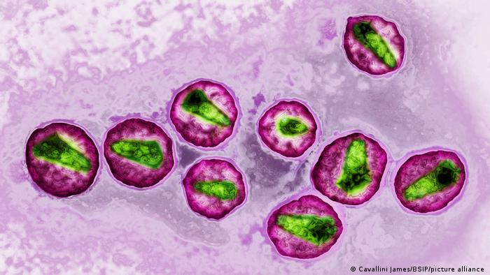 HIV Virus, Aids, HDRI Bild, Mikroskopische Aufnahme
