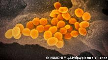Eine undatierte elektronenmikroskopische Aufnahme des «U.S. National Institute of Health» zeigt das neuartige Coronavirus (SARS-CoV-2) (orange), das aus der Oberfläche von im Labor kultivierten Zellen (grau) austritt. Die Probe wurde von einem Patienten in den USA isoliert. +++ dpa-Bildfunk +++