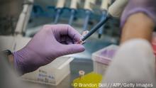 HOUSTON, TEXAS - AUGUST 13: Laboratory Technician David Salazar analyzes COVID-19 samples, during the polymerase chain reaction (PCR) preparation process, at the Genview Diagnosis lab on August 13, 2021 in Houston, Texas. Across the Houston metropolitan area, testing has significantly increased as the Delta variant overwhelms hospitals, and schools and business's continue to reopen. Houston has seen an upward increase of Delta infections, and research is showing the Delta variant to be 60% more contagious than its predecessor the Alpha variant, also known as COVID-19. Brandon Bell/Getty Images/AFP (Photo by Brandon Bell / GETTY IMAGES NORTH AMERICA / Getty Images via AFP)