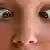 Eine Frau schaut auf ihre eigene Nasenspitze, beide Pupillen weisen stark nach innen. 
