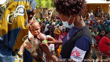 In this photo dated Friday Feb. 19, 2021, made available by Medecins Sans Frontieres, showing an MSF (Doctors Without Borders) staff member measuring a child's upper arm circumference to check for malnutrition in Meluco, in the northern Mozambican province of Cabo Delgado. Northern Mozambique's humanitarian crisis is quickly growing with more than 650 000 people displaced by the Islamic extremist insurgency in Cabo Delgado province according to a statement Tuesday March 16, 2021, from International aid groups. (AP Photo/MSF)