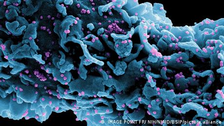Colorized scanning electron micrograph of a cell (blue) infected with a variant strain of SARS-CoV-2 virus particles (UK B.1.1.7 purple), isolated from a patient sample. Image captured at the NIAID Integrated Research Facility (IRF) in Fort Detrick, Maryland.
