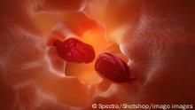 darm,endoskopie,polyp,därme,nesseltier,nesseltiere,polypen *** intestine,endoscopy,polyp,intestines,endoscopies g54-kz8