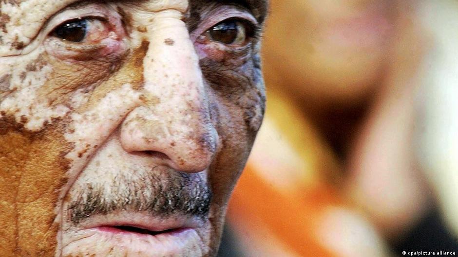 Banana farm pesticides back in focus after sterility ruling