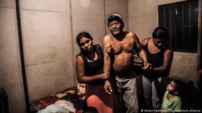 Ein Nierenkranker Mann aus Chichigalpa (Nicaragua) wird im Zimmer von 2 Frauen gestützt 