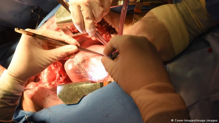 Surgeons' hands during a heart transplant surgery