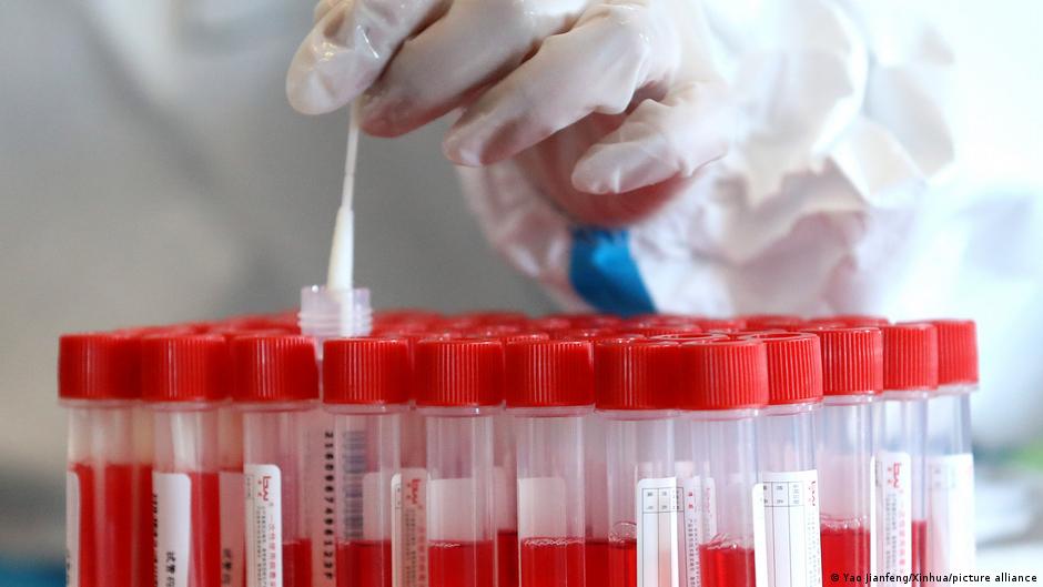Coronavirus digest: Germany records new daily record of infections | News | DW - Vimarsana News