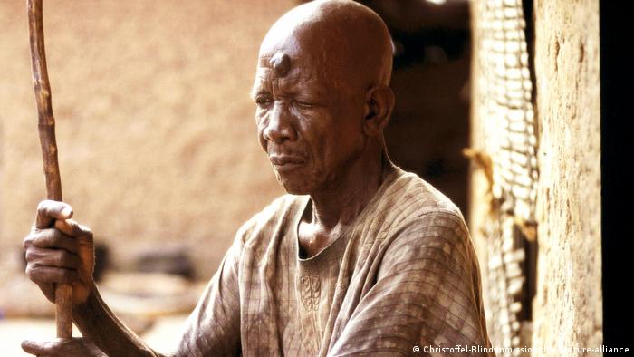 Ein ältererer Mann sitzt mit einem Stock vor seiner Hütte. Er ist blind durch Onchozerkose - Flussblindheit