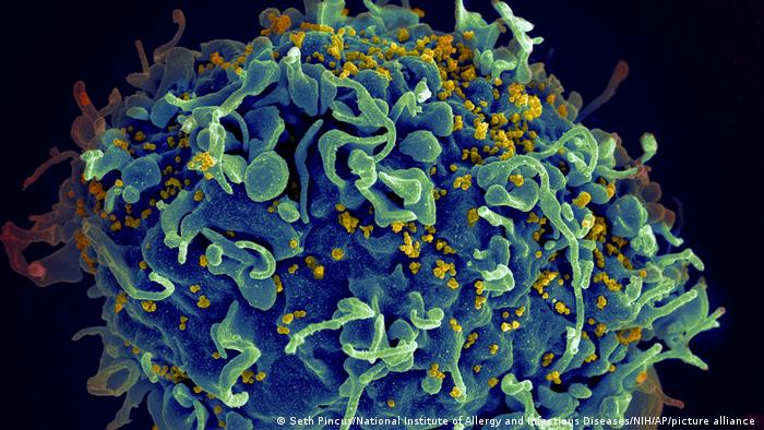 Una célula T humana, en azul, atacada por el VIH, en amarillo, el virus que causa el sida.