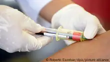 خلايا من الأقارب والرضع..شفاء أول امرأة من الفيروس المسبب للإيدز!