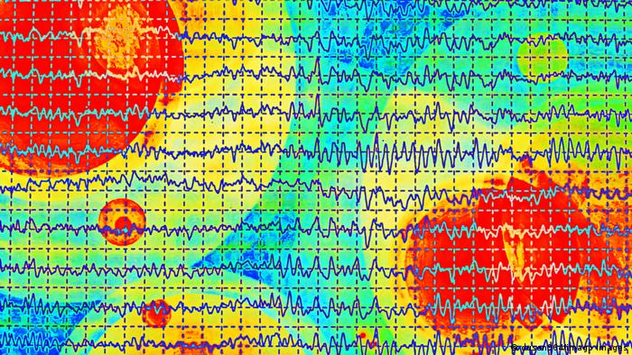 Moždani valovi prikazani na EEG-u