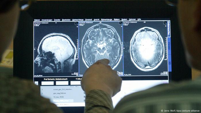 Agência reguladora aprova novo tratamento contra o Alzheimer na UE