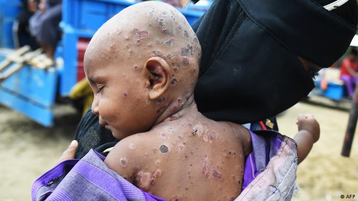 Bangladesch Myanmar Rohingya Flucht Genozid