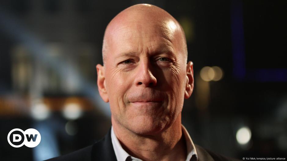 Actor Bruce Willis is diagnosed with frontotemporal dementia |  The World |  D.W.