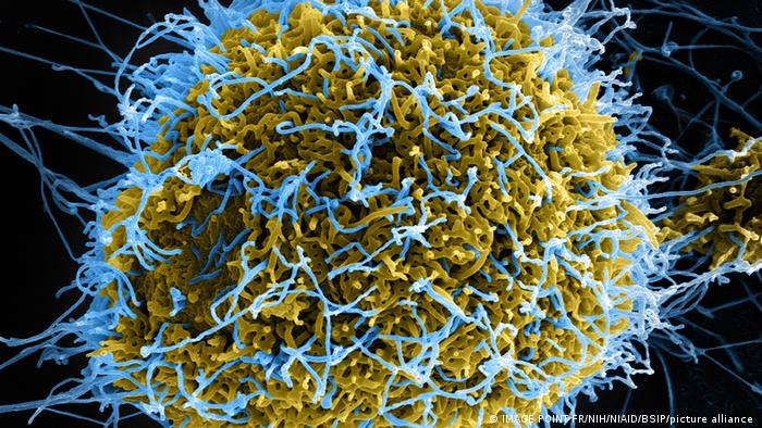 Micrografía electrónica de barrido teñida de partículas filamentosas del virus del Ébola (azul) que emergen de una célula VERO E6 infectada crónicamente (amarillo-verde).