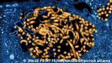 Micrographie électronique à transmission colorisée de nucléocapsides du virus Ebola (petits cercles orange) et de particules virales (formes filamenteuses orange plus grandes) dans des cellules rénales de singe vert africain infectées. Crédit: NIAID.