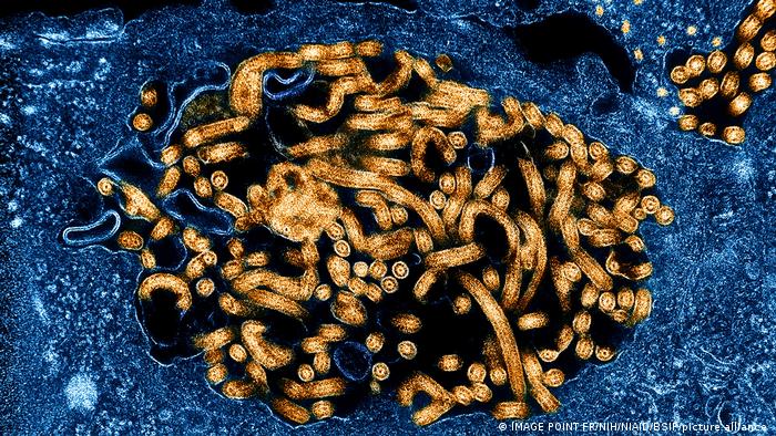 El virus del Ébola, fotografiado en un microscopio.