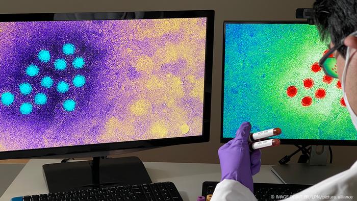 Imagen del virus de la hepatitis A en una computadora.