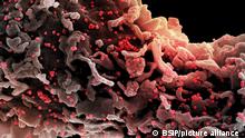 Colorized scanning electron micrograph of a cell (gray) infected with a variant strain of SARS-CoV-2 virus particles (UK B.1.1.7 red), isolated from a patient sample. Image captured at the NIAID Integrated Research Facility (IRF) in Fort Detrick, Maryland.