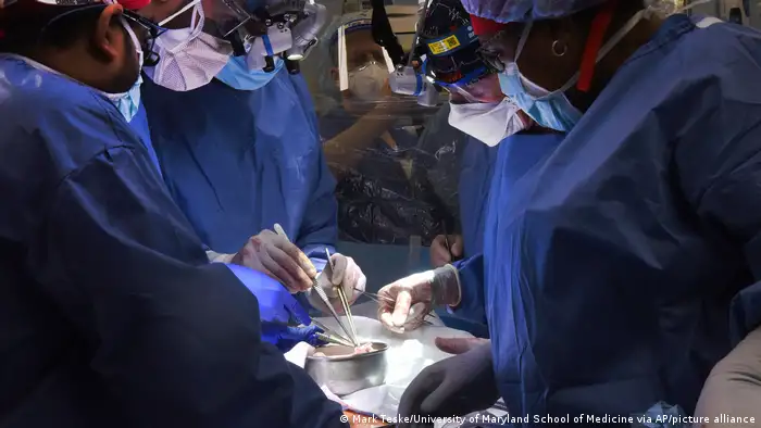الطاقم الطبي يقوم بزع قلب خنزير معدّل وراثيا في جسم رجل مريض. 