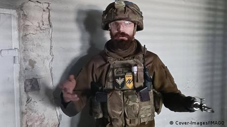 Хората буквално умират от болка всички са с отворени рани