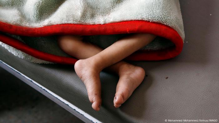 Behandlungszentrum gegen Unterernährung im Jemen: Die Füße eines unterernährtes Kindes, das mit einer Decke bedeckt auf einer grauen Liege liegt