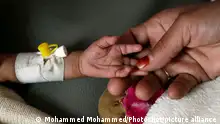 (191018) -- BEIJING, Oct. 18, 2019 () -- A woman holds the hand of her malnourished child as he receives medical treatment at the malnutrition treating department in Al-Sabeen hospital in Sanaa, Yemen, Oct. 17, 2019. At least one in three children under five across the globe are malnourished and not developing properly, the United Nations Children's Fund (UNICEF) revealed on Tuesday. October 17 marks the 27th International Day for the Eradication of Poverty. (Photo by Mohammed Mohammed/)