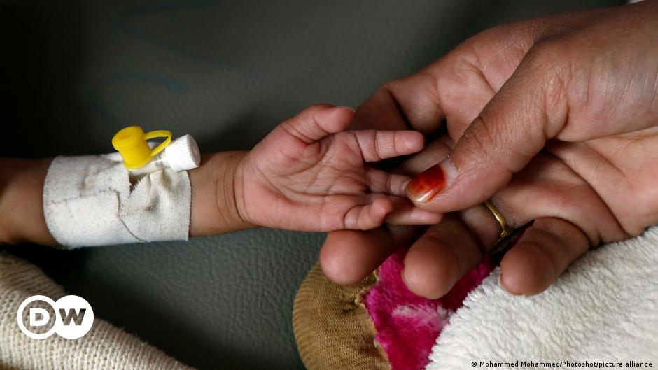 unicef-malnutrition-puts-8-million-children-at-risk-of-death-dw-23-06-2022