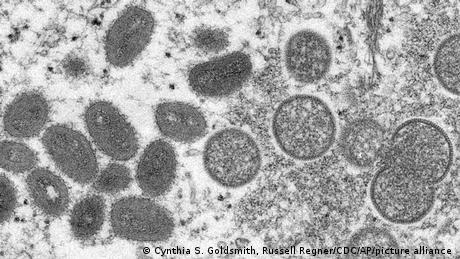 electron microscope image of monkeypox virus