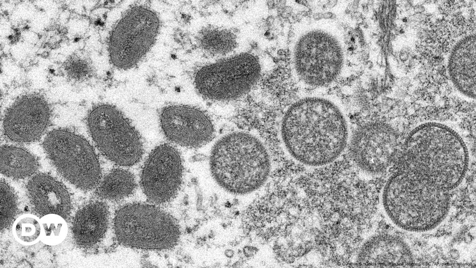L’Allemagne, la France et la Belgique confirment les premiers cas de grippe simienne  Nouvelles |  DW