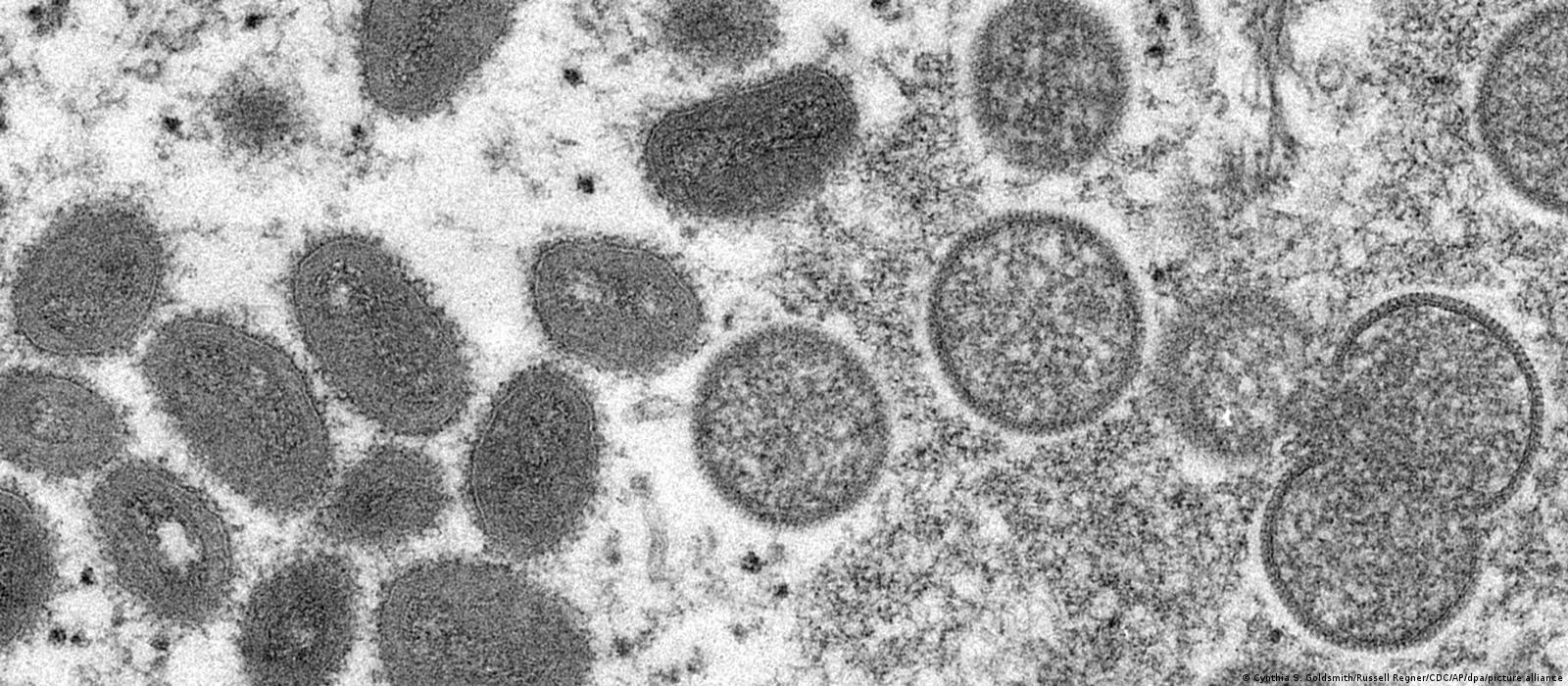 Virus vistos em microscópio