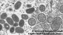 Imagem do vírus causador da varíola dos macacos