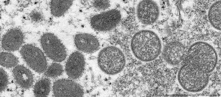 Vírus da varíola dos macacos: variante da África Ocidental é menos contagiosa e mais branda que a da África Central
