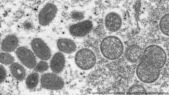 Imagen microscópica del virus de la viruela del mono: virus del mono ovalados (izda.) y viriones esféricos inmaduros (drcha.).