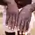Больной оспой обезьян во время вспышки болезни в Демократической республике Конго показывает свои руки (фото из архива) 