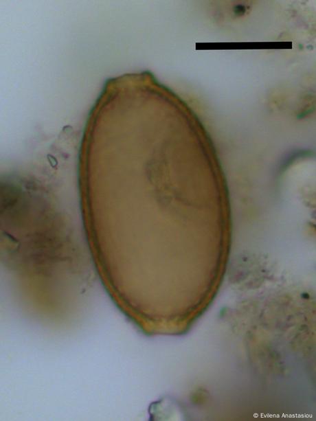 Huevo microscópico de gusano capilar de Durrington Walls. La barra de escala negra representa 20 micrómetros. 