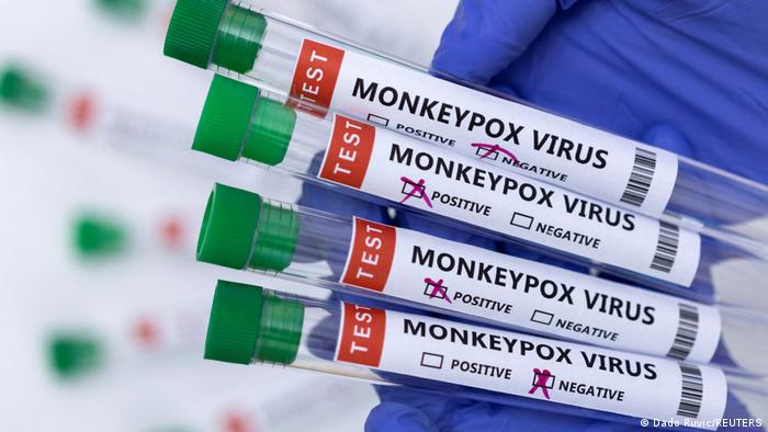 Imagen referencial de exámenes para la detección de la viruela del mono.