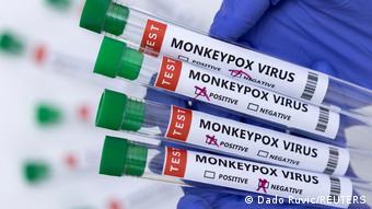 Imagen referencial de exámenes para la detección de la viruela del mono.