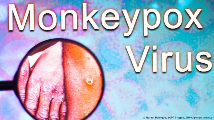 An iconic image of monkeypox under a magnifying glass - May 24, 2022