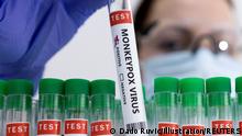 FILE PHOTO: Test tubes labelled Monkeypox virus positive are seen in this illustration taken May 23, 2022. REUTERS/Dado Ruvic/Illustration/File Photo