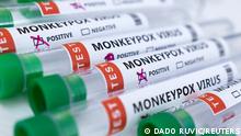 FILE PHOTO: Test tubes labelled Monkeypox virus positive and negative are seen in this illustration taken May 23, 2022. REUTERS/Dado Ruvic/Illustration/File Photo