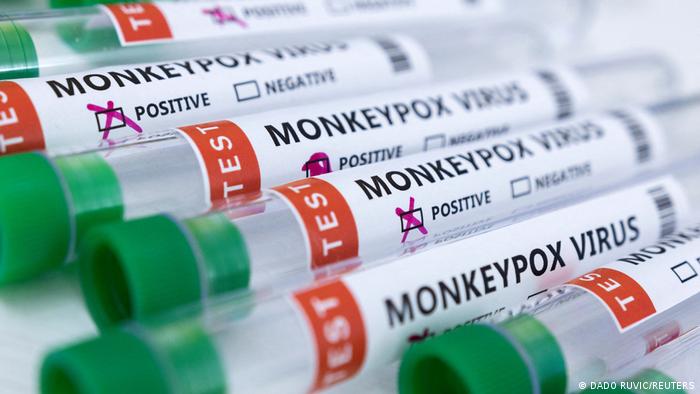 Brasil já registra 17 casos de varíola dos macacos