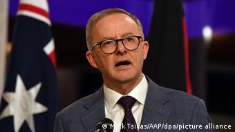 Άνθονι Αλμπανήζι