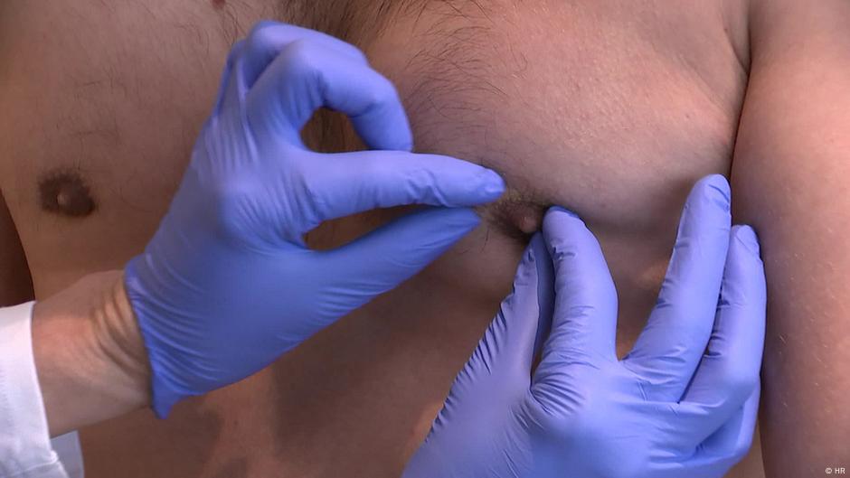 How to get rid of man boobs – DW – 07/08/2022